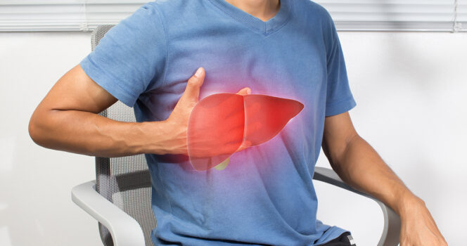 Stock Image Of Man With Fatty Liver. Credit / Shutterstock